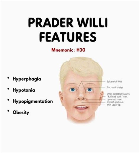 prader willi syndrome pws